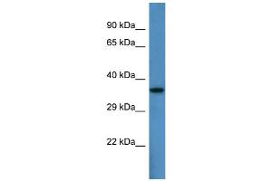 Host:  Rabbit  Target Name:  Pard6b  Sample Type:  Mouse Heart lysates  Antibody Dilution:  1. (PARD6B antibody  (N-Term))