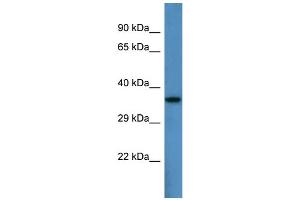 Host:  Rabbit  Target Name:  Pard6b  Sample Type:  Mouse Heart lysates  Antibody Dilution:  1. (PARD6B antibody  (N-Term))