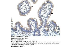 Human Intestine (NFKBIB antibody  (C-Term))