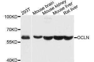 Western blot analysis of extracts of various cell lines, using OCLN antibody (ABIN4904607) at 1:1000 dilution. (Occludin antibody)