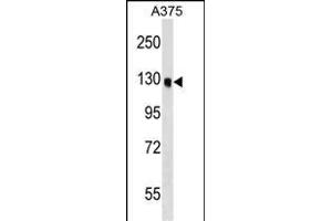 OSBPL6 antibody  (C-Term)