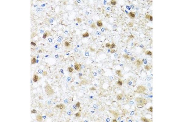 ZBTB17 antibody  (AA 121-360)