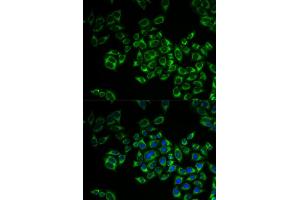 Immunofluorescence analysis of MCF-7 cell using FIS1 antibody. (Fission 1 antibody)