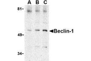 AP20057PU-N Beclin-1 antibody staining of A431 cell lysate by Western Blotting at (A) 0. (Beclin 1 antibody  (C-Term))