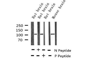 Western Blotting (WB) image for anti-Retinoblastoma 1 (RB1) (pSer795) antibody (ABIN6255512)