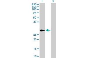 Western Blot analysis of FHL1 expression in transfected 293T cell line by FHL1 MaxPab polyclonal antibody. (FHL1 antibody  (AA 1-280))