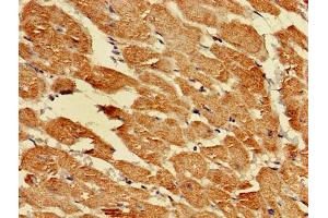 Immunohistochemistry (IHC) image for anti-Lactate Dehydrogenase D (LDHD) (AA 310-507) antibody (ABIN7164407)