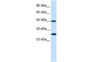 WB Suggested Anti-PSMD4 Antibody Titration:  0. (PSMD4/ASF antibody  (N-Term))