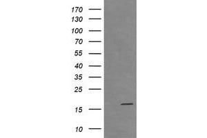 Image no. 1 for anti-Cancer/testis Antigen 1B (CTAG1B) antibody (ABIN1499889) (CTAG1B antibody)