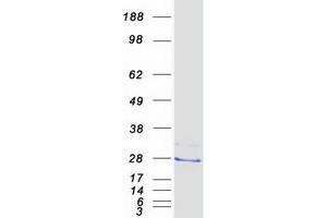 Western Blotting (WB) image for Progesterone Receptor Membrane Component 2 (PGRMC2) protein (Myc-DYKDDDDK Tag) (ABIN2728799)