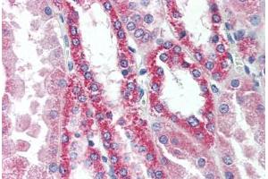 Human Kidney (formalin-fixed, paraffin-embedded) stained with SNF1LK2 antibody ABIN297633 at 10 ug/ml followed by biotinylated goat anti-rabbit IgG secondary antibody ABIN481713, alkaline phosphatase-streptavidin and chromogen. (SIK2 antibody  (AA 100-150))