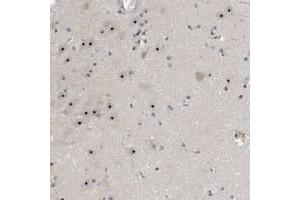 Immunohistochemical staining of human hippocampus with NOL11 polyclonal antibody  shows strong nucleolar positivity in neuronal cells at 1:20-1:50 dilution.