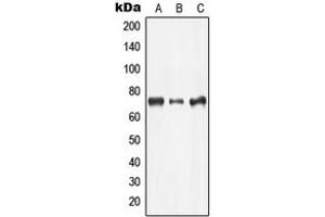 Western blot analysis of LIMK2 expression in Jurkat (A), COLO205 (B), MCF7 (C) whole cell lysates. (LIMK2 antibody  (Center))