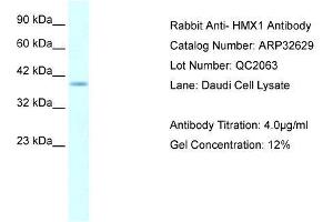 WB Suggested Anti-HMX1 AntibodyTitration: 4. (HMX1 antibody  (Middle Region))