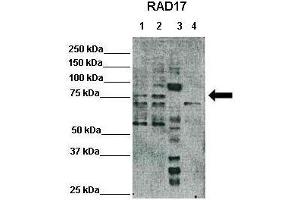 WB Suggested Anti-RAD17 Antibody  Positive Control: Lane1: 25ug Hela lysate, Lane2: 25ug HEK293T lysate, Lane3: 25ug Xenopus laevis egg extract, Lane4: 25ug mouse embryonic stem cells lysate Primary Antibody Dilution :  1:500 Secondary Antibody :  Anti-rabbit-HRP  Secondry Antibody Dilution :  1:3000 Submitted by: Domenico Maiorano, Institute of Human Genetics, CNRS (RAD17 antibody  (C-Term))