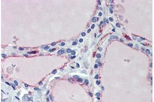 Thyroid, Human: Formalin-Fixed, Paraffin-Embedded (FFPE) (EHD4 antibody  (AA 396-445))