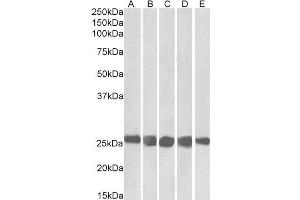 ABIN5539634 (0. (CSNK2B antibody  (AA 172-186))