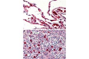 Immunohistochemistry (Formalin/PFA-fixed paraffin-embedded sections) of human lung (A) and human spleen, red pulp (B) tissue with GPR132 polyclonal antibody . (G Protein-Coupled Receptor 132 antibody  (Cytoplasmic Domain))