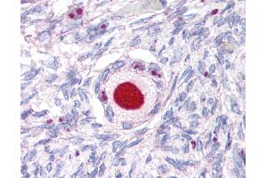 Anti-NR5A1 antibody IHC of human ovary. (NR5A1 antibody  (Internal Region))