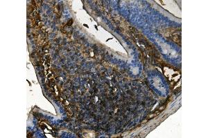 IHC analysis of RENT1/hUPF1 using anti-RENT1/hUPF1 antibody (ABIN7602979). (RENT1/UPF1 antibody  (Middle Region))