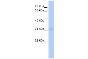 AES antibody used at 0. (AES antibody  (Middle Region))