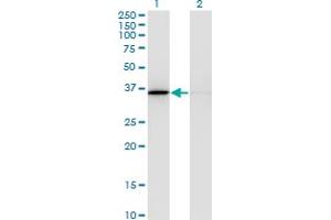 Western Blot analysis of MDH1 expression in transfected 293T cell line by MDH1 monoclonal antibody (M03), clone 1D2. (MDH1 antibody  (AA 101-193))