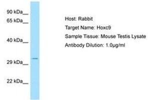 Image no. 1 for anti-Homeobox C9 (HOXC9) (C-Term) antibody (ABIN6749849) (HOXC9 antibody  (C-Term))