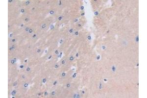 Detection of MYL3 in Mouse Cerebrum Tissue using Polyclonal Antibody to Myosin Light Chain 3, Alkali, Ventricular, Slow Skeletal (MYL3)