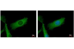 ICC/IF Image NDUFS2 antibody detects NDUFS2 protein at mitochondria by immunofluorescent analysis. (NDUFS2 antibody  (Center))