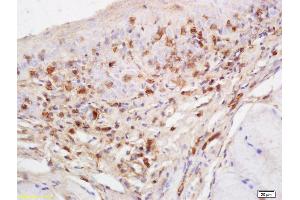 Formalin-fixed and paraffin embedded rat tongue labeled with Anti-RASA3 Polyclonal Antibody, Unconjugated (ABIN760316) at 1:200 followed by conjugation to the secondary antibody and DAB staining (RASA3 antibody  (AA 501-600))