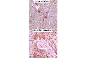 Immunohistochemical analysis of paraffin-embedded human brain tissue and lung carcinoma tissue, showing nuclear/cytoplasmic localization using MAPK10 monoclonal antibody, clone 8A5D11  with DAB staining.