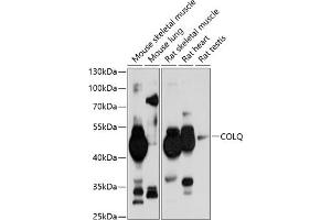 Western blot analysis of extracts of various cell lines, using COLQ antibody (ABIN6131427, ABIN6138859, ABIN6138860 and ABIN6214704) at 1:1000 dilution. (COLQ antibody  (AA 276-455))
