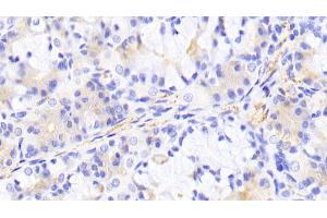 Detection of PIK3Cb in Human Stomach Tissue using Polyclonal Antibody to Phosphoinositide-3-Kinase Catalytic Beta Polypeptide (PIK3Cb) (PIK3CB antibody  (AA 524-703))