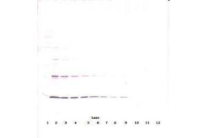 Image no. 3 for anti-Leptin (LEP) antibody (ABIN465530) (Leptin antibody)