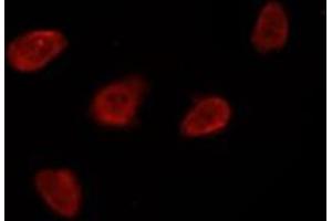 ABIN6269396 staining Hela by IF/ICC. (HDAC8 antibody  (N-Term))