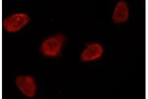 ABIN6269396 staining Hela by IF/ICC. (HDAC8 antibody  (N-Term))