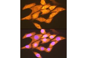 Immunofluorescence analysis of NIH-3T3 cells using FGF1 Rabbit mAb (ABIN7267182) at dilution of 1:100 (40x lens). (FGF1 antibody)