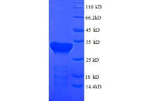 SDS-PAGE (SDS) image for Cytochrome C Oxidase Subunit IV Isoform 1 (COX4I1) (AA 23-169) protein (His-SUMO Tag) (ABIN5709313) (COX IV Protein (AA 23-169) (His-SUMO Tag))