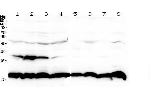 Western blot analysis of Cyclophilin B using anti-Cyclophilin B antibody . (PPIB antibody  (AA 158-216))