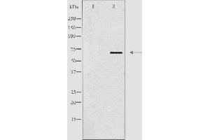 Western blot analysis of extracts from Jurkat cells, using TBX18 antibody. (T-Box 18 antibody  (Internal Region))