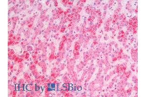 ABIN2613452 (5µg/ml) staining of paraffin embedded Human Liver. (MSI2 antibody  (N-Term))