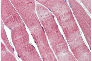 Human Skeletal Muscle: Formalin-Fixed, Paraffin-Embedded (FFPE) (PGAM2 antibody)