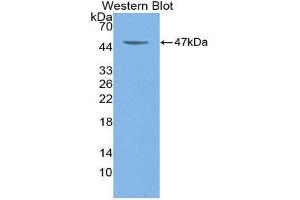 Western Blotting (WB) image for anti-Colony Stimulating Factor 2 (Granulocyte-Macrophage) (CSF2) (AA 18-144) antibody (ABIN3209610) (GM-CSF antibody  (AA 18-144))