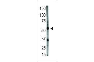 The anti-GDF5 N-term Pab (ABIN388820 and ABIN2839138) is used in Western blot to detect GDF5 in A549 cell lysate. (GDF5 antibody  (N-Term))