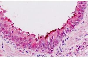 Human Lung, Respiratory Epithelium: Formalin-Fixed, Paraffin-Embedded (FFPE) (SIX4 antibody  (AA 672-781))