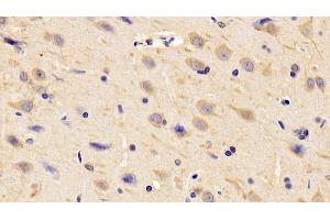 Detection of CHEM in Rat Cerebrum Tissue using Polyclonal Antibody to Chemerin (CHEM) (Chemerin antibody  (AA 25-152))