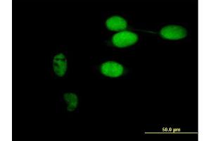 Immunofluorescence of purified MaxPab antibody to TIMELESS on HeLa cell. (TIMELESS antibody  (AA 1-1208))
