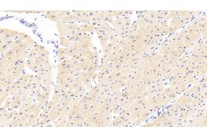 Detection of PARP4 in Human Cardiac Muscle Tissue using Polyclonal Antibody to Poly ADP Ribose Polymerase 4 (PARP4) (PARP4 antibody  (AA 338-609))