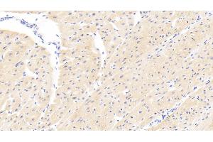 Detection of PARP4 in Human Cardiac Muscle Tissue using Polyclonal Antibody to Poly ADP Ribose Polymerase 4 (PARP4) (PARP4 antibody  (AA 338-609))