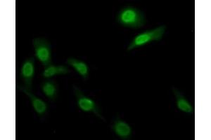 Detection of FADS2 in Human HepG2 cell using Polyclonal Antibody to Fatty Acid Desaturase 2 (FADS2) (FADS2 antibody  (AA 1-130))